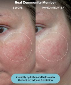 Hydrating Electrolyte Rescue Serum