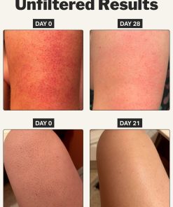 KP smoothing stick