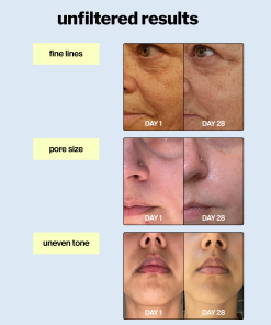 advanced retinol gel 0.5%