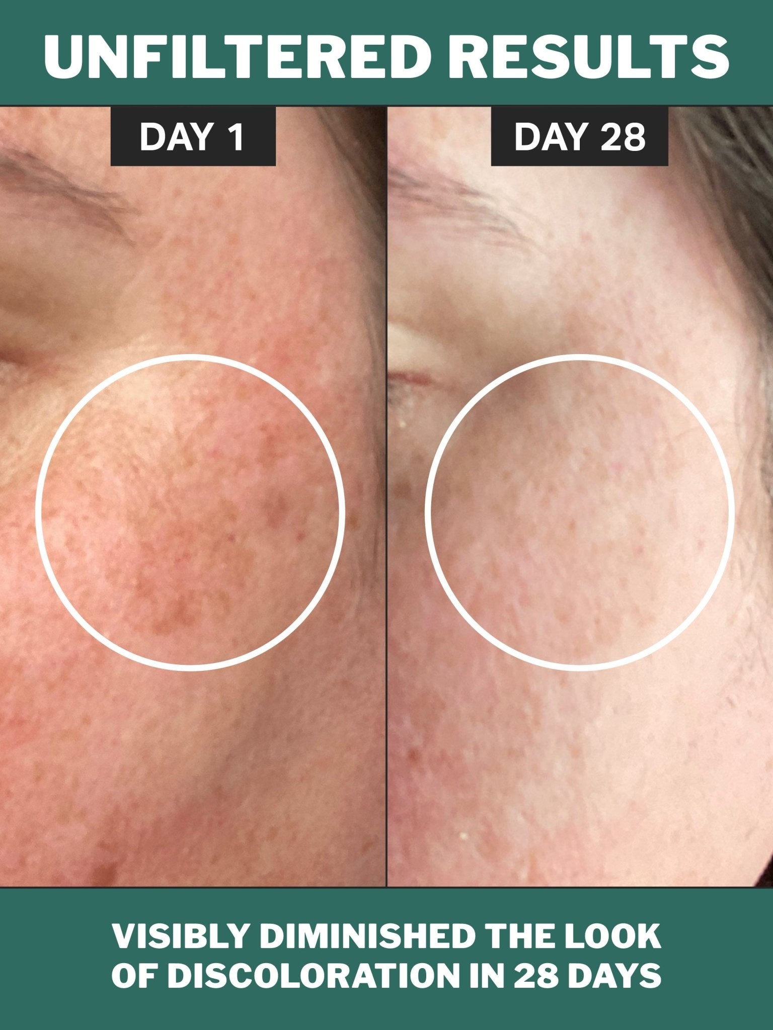 sm-image-de8e02ab5043b86ec61074b9 chlorophyll discoloration serum