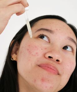 postbiotic acne serum