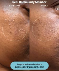 Hydrating Electrolyte Rescue Serum